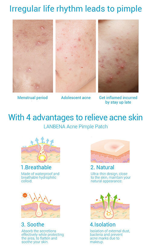 LANBENA Acne Pimple Patch(Daily use)-Skin care-1stAvenue