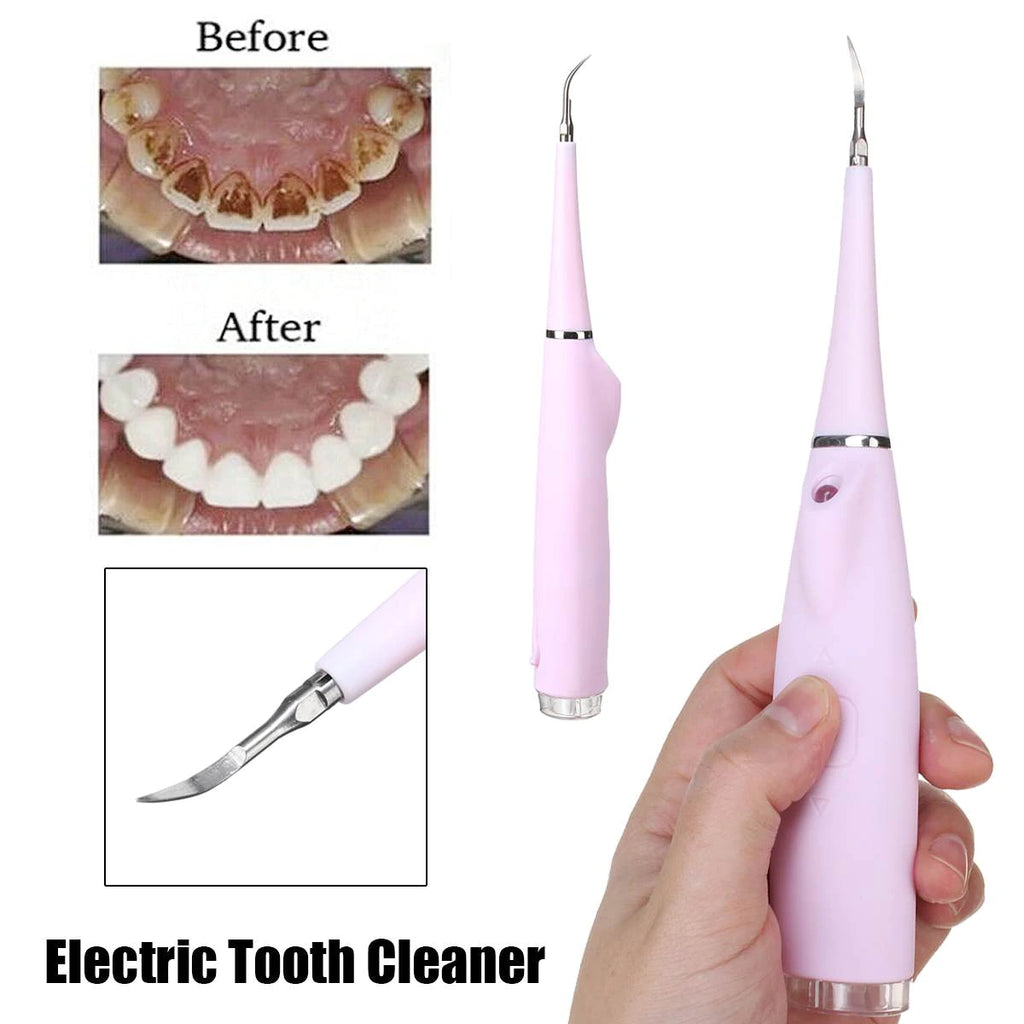 Portable Electric Oral Irrigator Teeth Cleaner Calculus Removal Dental Hygiene Dental Water Flosser Tooth Cleaner Rechargable-beauty tool-1stAvenue