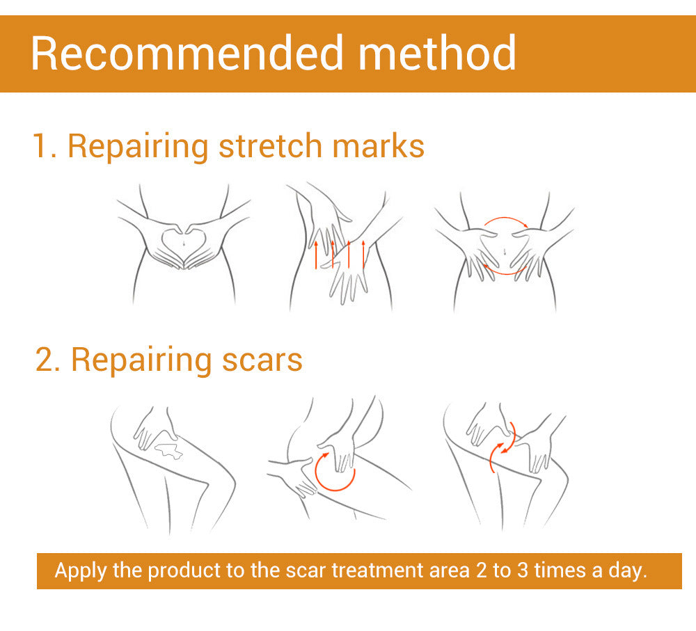 LANBENA Scar Removal Stretch Marks 20ml-Skin care-1stAvenue