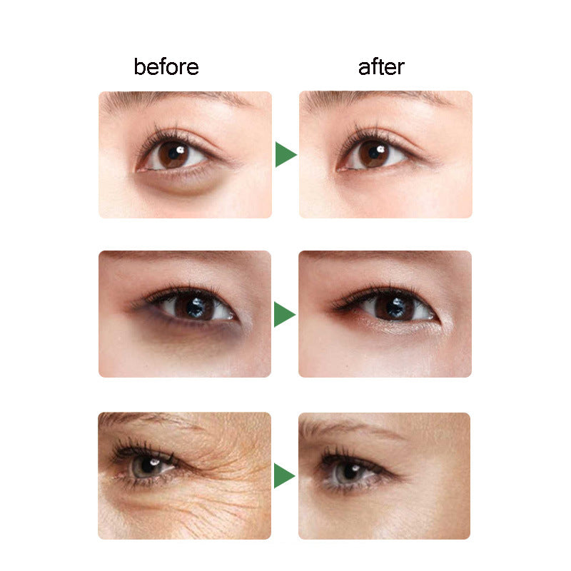 Aichun Beauty Dark Eye Circles Wrinkles Cream Natural Moisturizing Aloe Vera-Beauty Product-1stAvenue