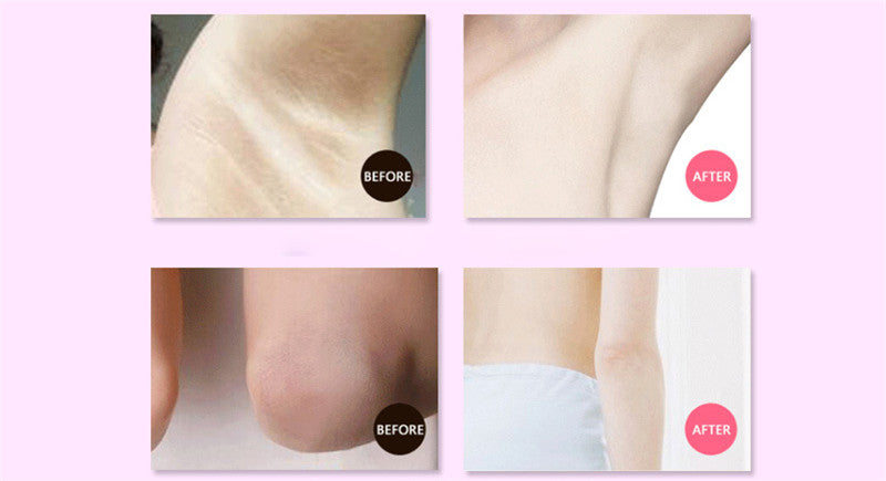 Aichun Beauty Skin Armpit Whitening Cream Skin Lightening Bleaching Cream-Skin care-1stAvenue