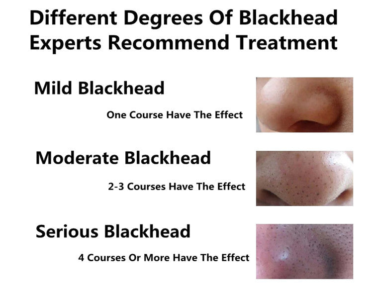 Buy 1 get 1 FREE Bioaqua Charcoal Blackhead Mask-Blackhead-1stAvenue