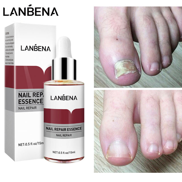LANBENA Nail Repair Essence Serum-Beauty Product-1stAvenue