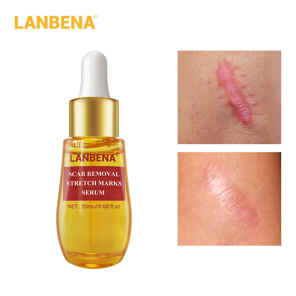 LANBENA Scar Removal Stretch Marks 20ml-Skin care-1stAvenue